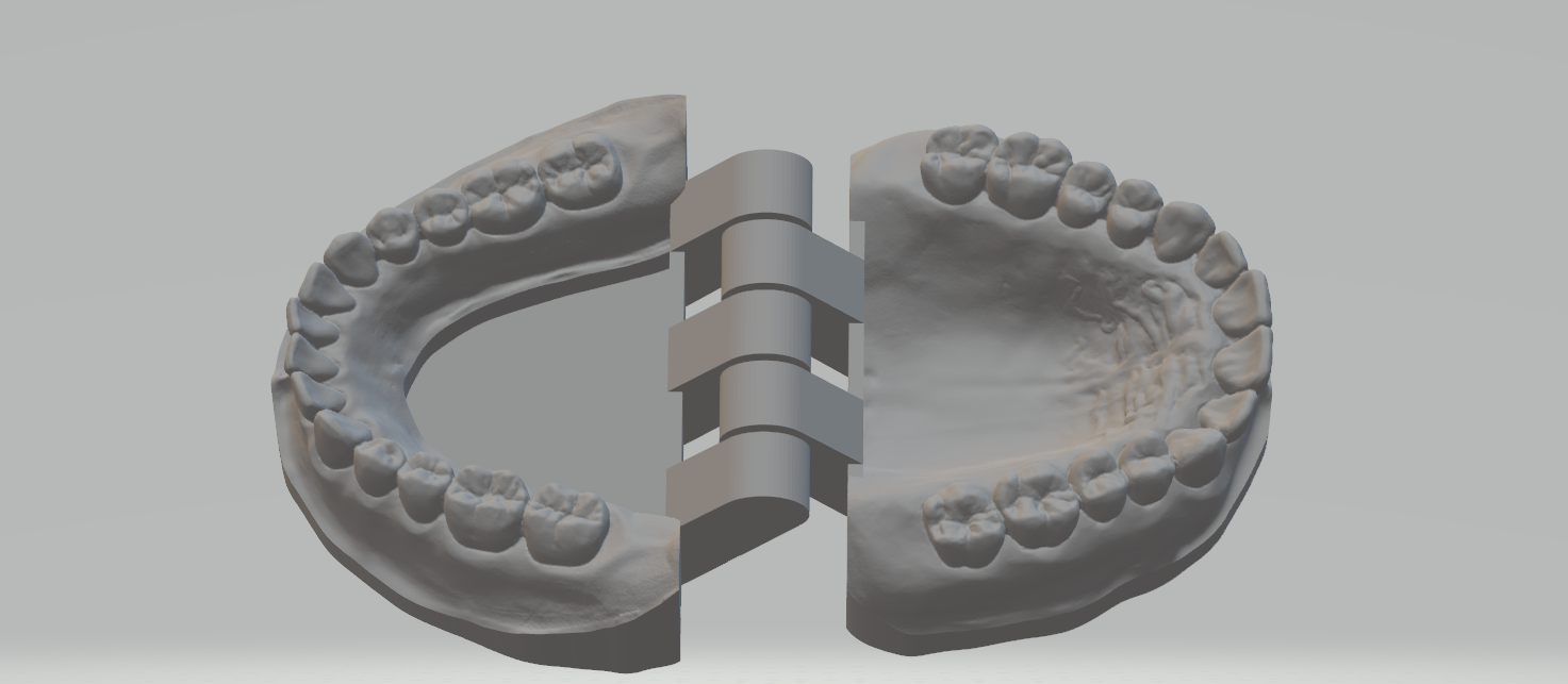 superhero STL files-collectible 3D figurines_Denture